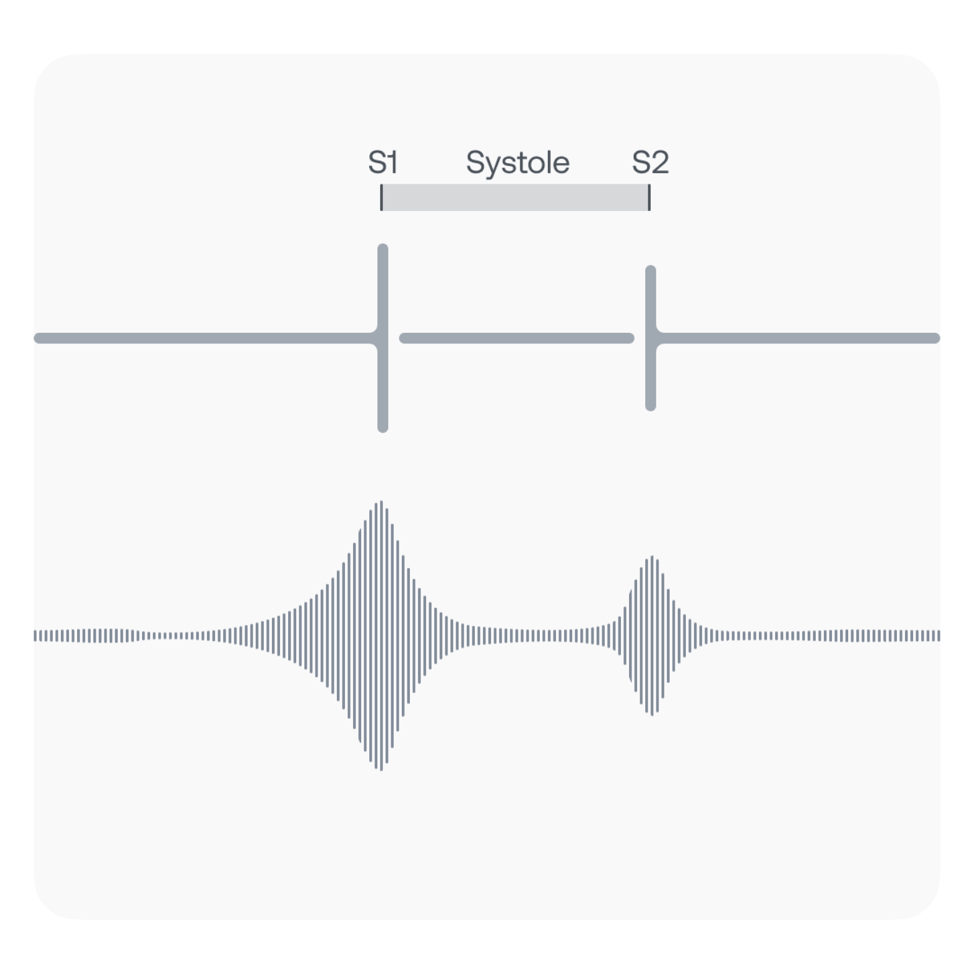 Eko Health What Are Systolic Murmurs