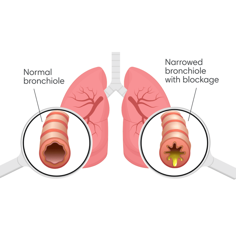 Eko Digital Stethoscopes, AI Disease Detection, & Telehealth