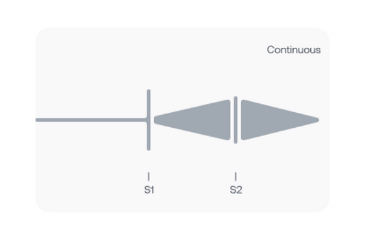 Graphical representation of Continuous Murmurs from S1 to after S2