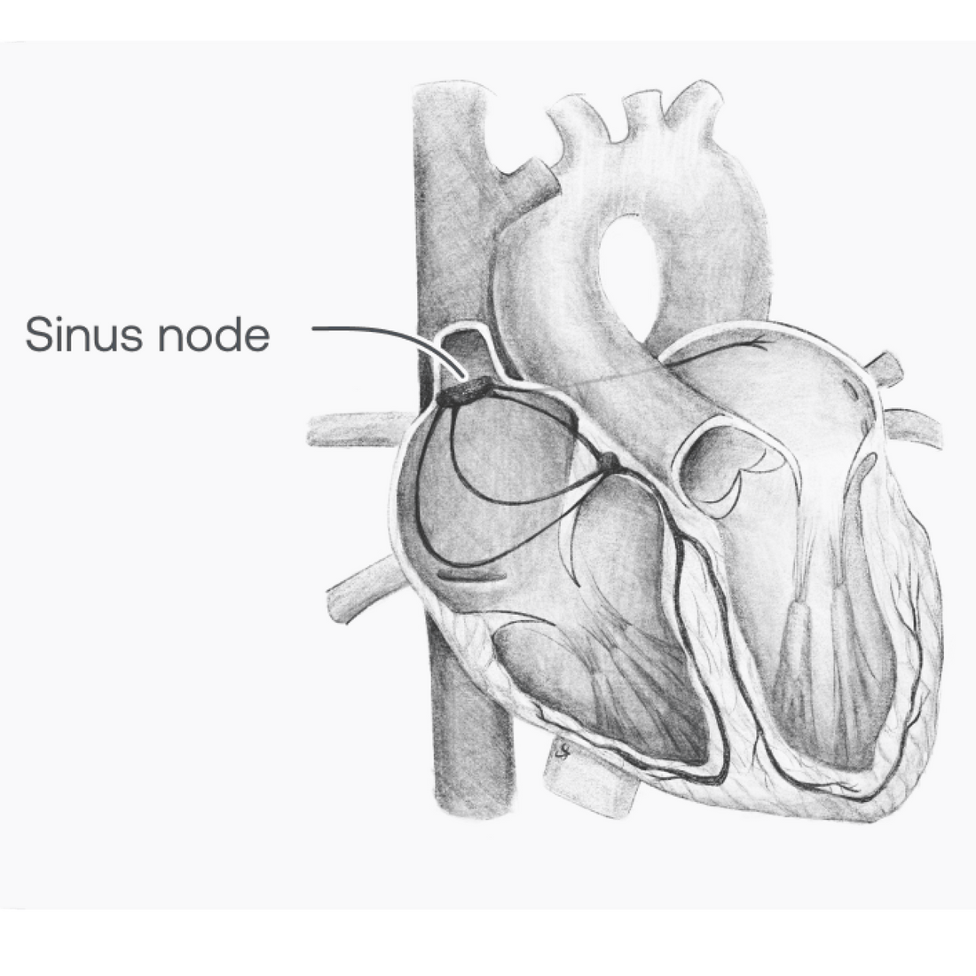 Eko Health | Sinus Node & Atrial Depolarization