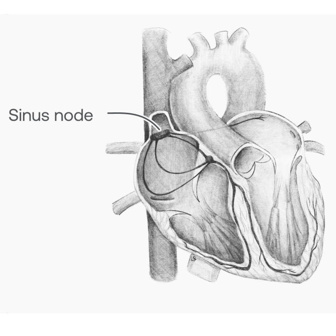 Ppencil drawing of the heart anatomy highlighting the sinus node