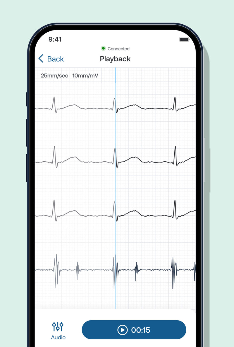 Eko Health Student Discounts for Eko & Littmann Stethoscopes