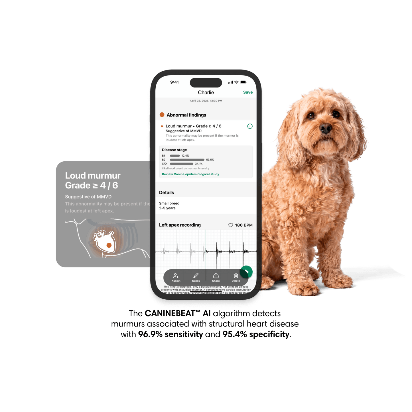 3M™ Littmann® CORE Digital Stethoscope