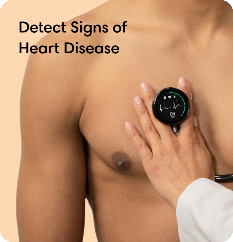 Automated Heart Disease Detection